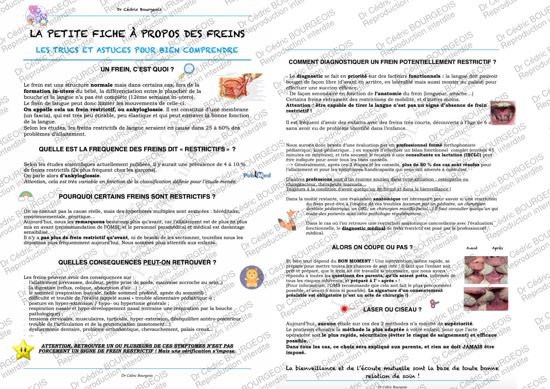 Trucs et astuces à propos des freins de langue